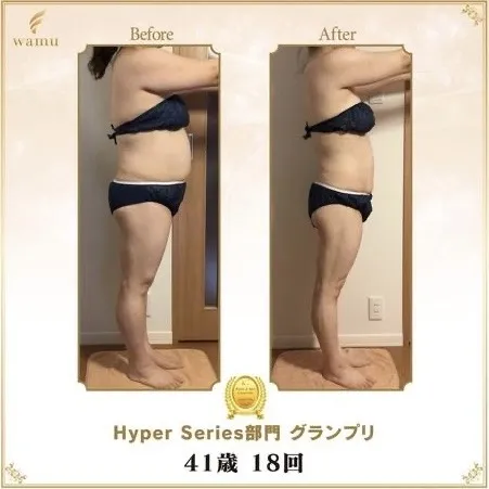 Hyper Series部門 グランプリ